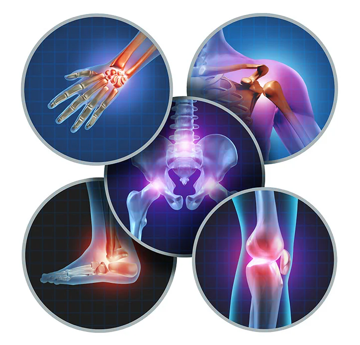 HOMEOPATHIC AID FOR RELIEF IN JOINT PAIN